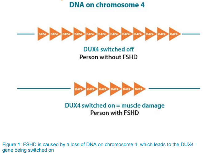 Image showing DNA on chromosome 4 on person who doesn't have FSHD where the DUX4 gene has been switched off compared to a person who does have FSHD where a loss of DNA on chromosome 4 leads to the DUX4 gene being switched on which causes muscle damage